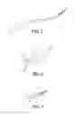 Fig. 02 - Uterine Manipulator and Cutting Unit