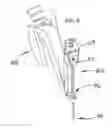 Fig. 08 - Alternate instrument removal