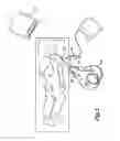 Fig. 06 - Medical device control system