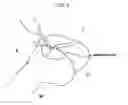 Fig. 05 - Method and system for cutting knee joint using robot