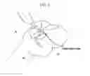 Fig. 07 - Method and system for cutting knee joint using robot