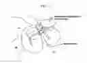 Fig. 08 - Method and system for cutting knee joint using robot
