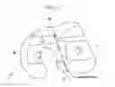 Fig. 12 - Method and system for cutting knee joint using robot