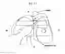 Fig. 13 - Method and system for cutting knee joint using robot