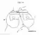 Fig. 14 - Method and system for cutting knee joint using robot