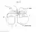 Fig. 15 - Method and system for cutting knee joint using robot