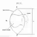 Fig. 17 - Method and system for cutting knee joint using robot