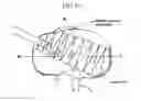 Fig. 22 - Method and system for cutting knee joint using robot