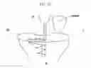 Fig. 25 - Method and system for cutting knee joint using robot