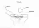 Fig. 26 - Method and system for cutting knee joint using robot