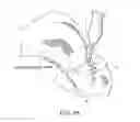 Fig. 28 - Method and system for cutting knee joint using robot