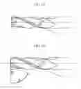 Fig. 32 - Method and system for cutting knee joint using robot