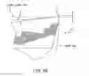Fig. 34 - Method and system for cutting knee joint using robot