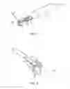 Fig. 03 - Endoscopic Suturing Device, System and Method