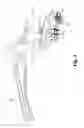 Fig. 05 - Skin suturing device using rotating needles