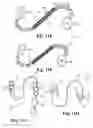 Fig. 16 - Skin suturing device using rotating needles