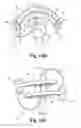 Fig. 23 - Skin suturing device using rotating needles