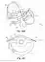 Fig. 25 - Skin suturing device using rotating needles