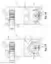 Fig. 33 - Skin suturing device using rotating needles
