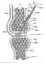 Fig. 01 - Method of securing tissue