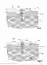 Fig. 03 - Method of securing tissue