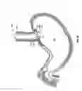 Fig. 08 - METHOD AND DEVICE FOR USE IN ENDOSCOPIC ORGAN PROCEDURES