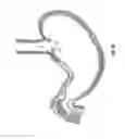 Fig. 09 - METHOD AND DEVICE FOR USE IN ENDOSCOPIC ORGAN PROCEDURES