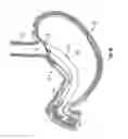 Fig. 10 - METHOD AND DEVICE FOR USE IN ENDOSCOPIC ORGAN PROCEDURES