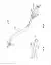 Fig. 13 - METHOD AND DEVICE FOR USE IN ENDOSCOPIC ORGAN PROCEDURES