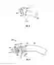 Fig. 16 - METHOD AND DEVICE FOR USE IN ENDOSCOPIC ORGAN PROCEDURES
