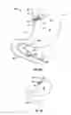 Fig. 24 - METHOD AND DEVICE FOR USE IN ENDOSCOPIC ORGAN PROCEDURES