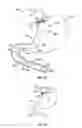 Fig. 25 - METHOD AND DEVICE FOR USE IN ENDOSCOPIC ORGAN PROCEDURES
