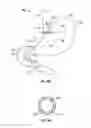 Fig. 27 - METHOD AND DEVICE FOR USE IN ENDOSCOPIC ORGAN PROCEDURES