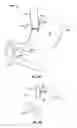 Fig. 29 - METHOD AND DEVICE FOR USE IN ENDOSCOPIC ORGAN PROCEDURES