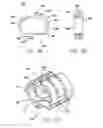 Fig. 12 - Single fold device for tissue fixation