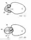 Fig. 50 - Single fold device for tissue fixation