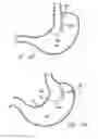 Fig. 55 - Single fold device for tissue fixation