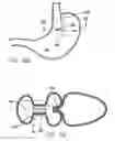 Fig. 60 - Single fold device for tissue fixation