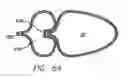 Fig. 63 - Single fold device for tissue fixation