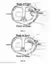 Fig. 08 - System and method for treating cartilage