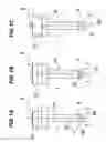 Fig. 02 - CANNULA AND METHOD OF MANUFACTURING THE CANNULA