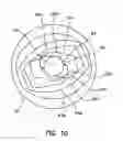 Fig. 07 - Blunt tip obturator