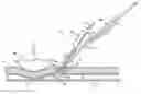 Fig. 01 - Monorail system for vascular closure device and methods