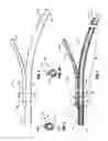 Fig. 02 - Monorail system for vascular closure device and methods