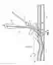 Fig. 04 - Monorail system for vascular closure device and methods