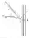 Fig. 07 - Monorail system for vascular closure device and methods