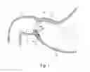 Fig. 02 - Devices and methods for altering eating behavior