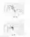 Fig. 04 - Devices and methods for altering eating behavior