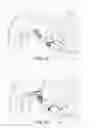 Fig. 05 - Devices and methods for altering eating behavior
