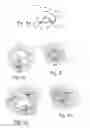 Fig. 08 - Devices and methods for altering eating behavior